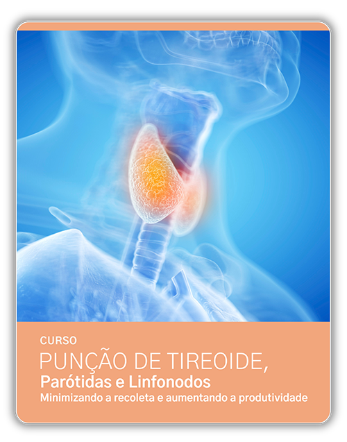CM PT PUCT - Curso Técnica de Punção de Tireoide, Parótidas e Linfonodos- minimizando a recoleta e aumentando a produtividade