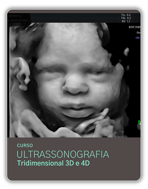 CM US 3D4D - Curso Ultrassonografia Tridimensional 3D e 4D