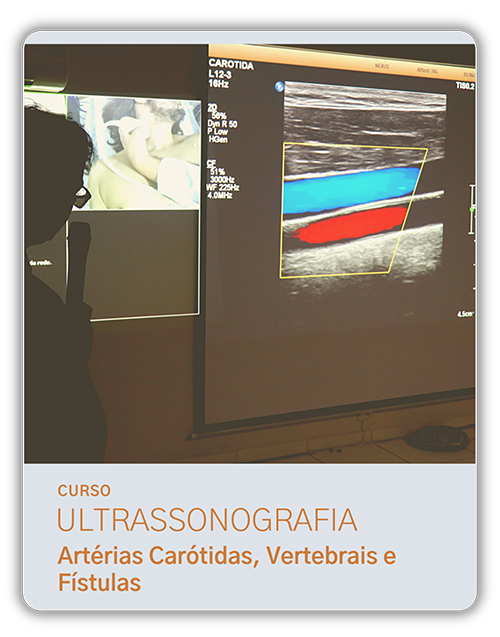 CM US CAVF - Curso Ultrassonografia das Artérias Carótidas, Vertebrais e Fístulas