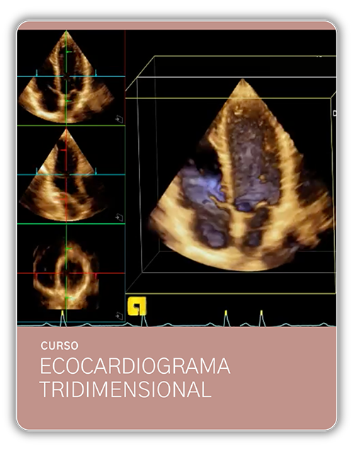 CM US EC3D - Curso Ecocardiograma Tridimensional