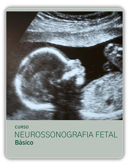 CM US NEF1 - Curso Neurossonografia Fetal Básico