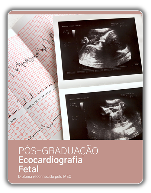PG US ECOF - Pós-graduação em Ecocardiografia Fetal