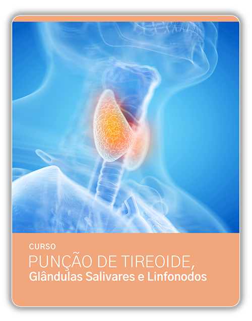 CM PT PUCT - Punção de tireoide,glandulas salivares e linfonodos